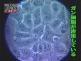 注入前に撮影した細胞の様子