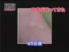 45日後の様子