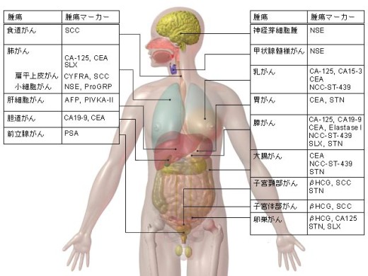 臓器別に見る主な腫瘍メーカー